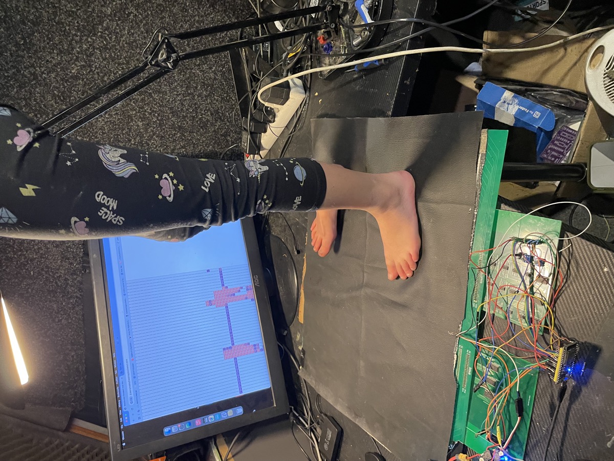 Pelmatografos foot pressure scanning hardware